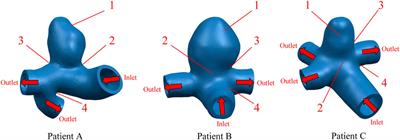 The biomechanical effects of different membrane layer structures and material constitutive modeling on patient-specific cerebral aneurysms